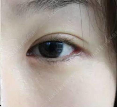 做过双眼皮的女明星,揭秘那些美丽蜕变的女明星